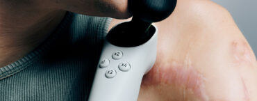 Xbox ha presentato il Joystick Adattivo per utenti con disabilità